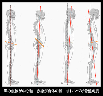 世の中の98%の人は身体のバランスが崩れている